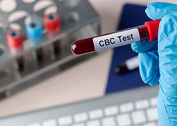 هل تحليل CBC يكشف الفيروسات